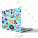 ⁦Quickstick kissy⁩ - الصورة ⁦2⁩